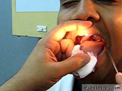 practical 2