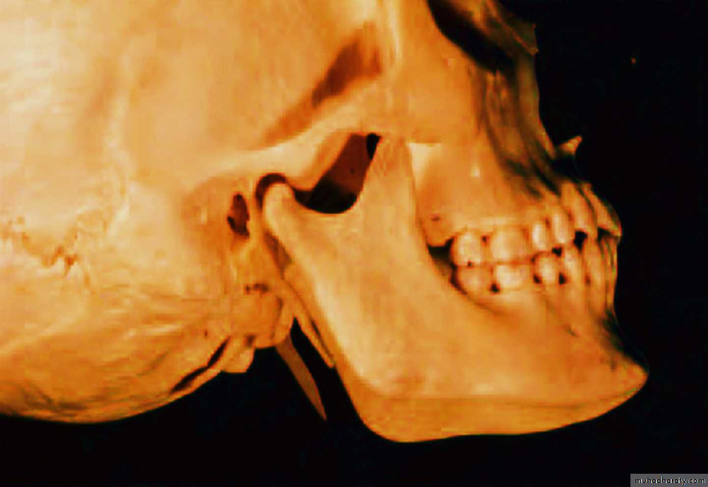 the head