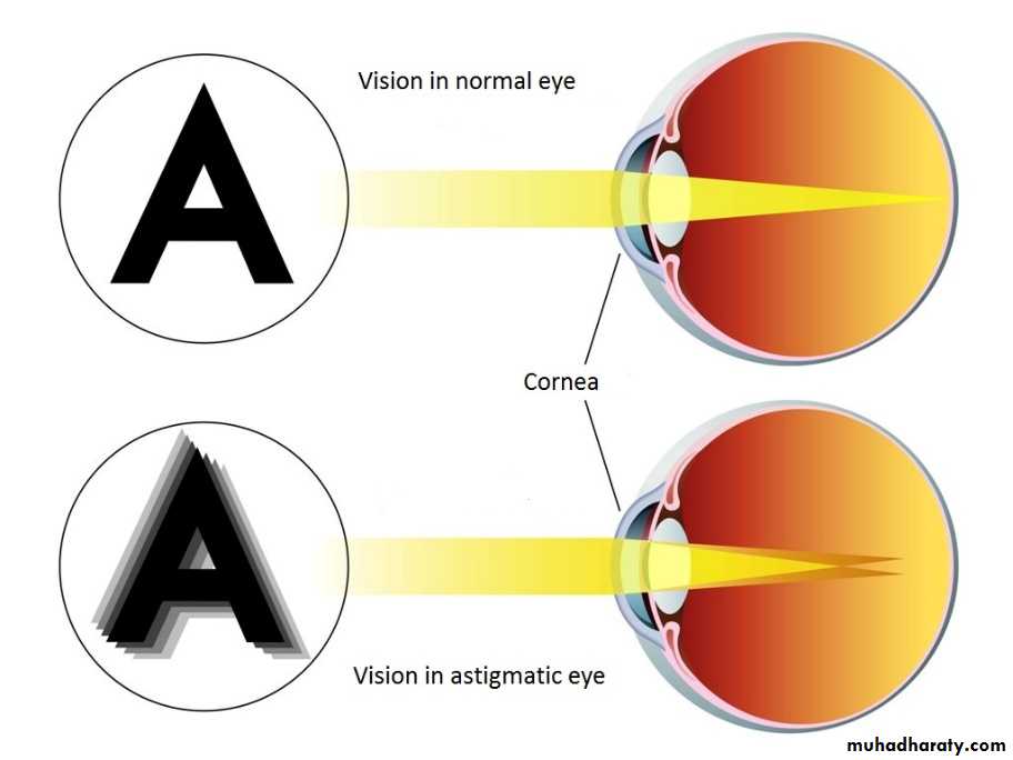 Vision