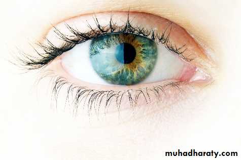 Vision