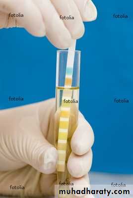 Diabetes mellitus