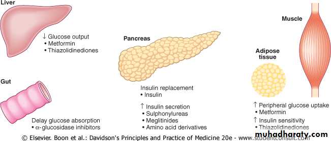 Diabetes mellitus