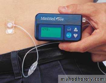 Diabetes mellitus