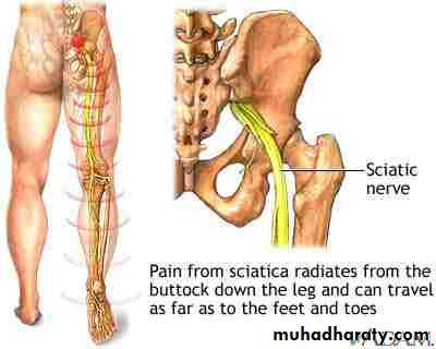 DISLOCATION OF HIP