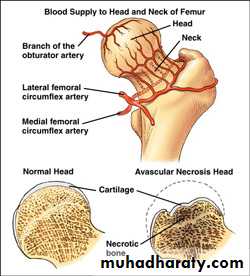 DISLOCATION OF HIP