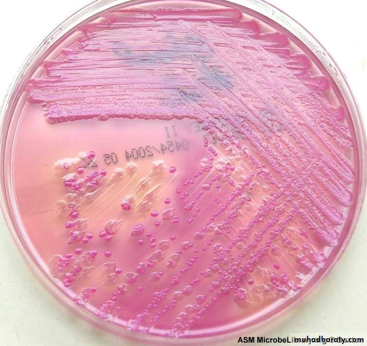 Family enterobacteriaceae بوربوينت