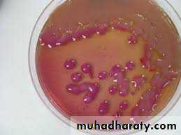 Family enterobacteriaceae بوربوينت
