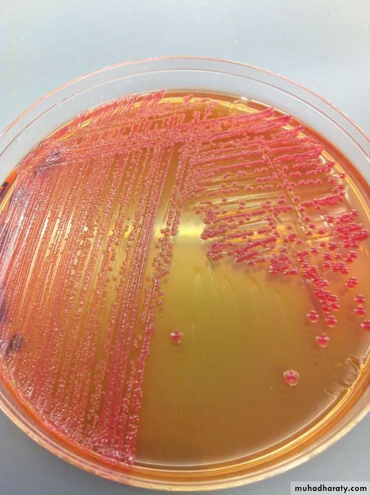 Family enterobacteriaceae بوربوينت