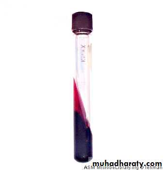 Family enterobacteriaceae بوربوينت