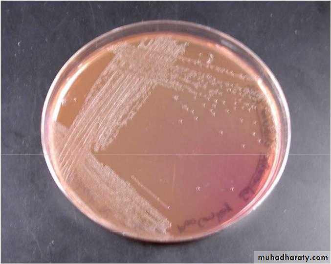 Family enterobacteriaceae بوربوينت