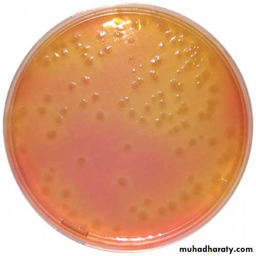 Family enterobacteriaceae بوربوينت