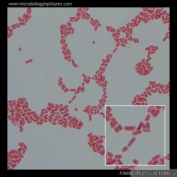 Family enterobacteriaceae بوربوينت