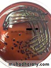 Family enterobacteriaceae بوربوينت