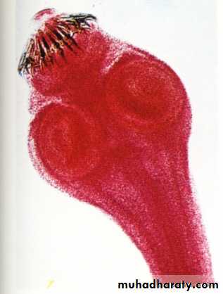 Cestodes وورد