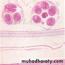 Cestodes وورد