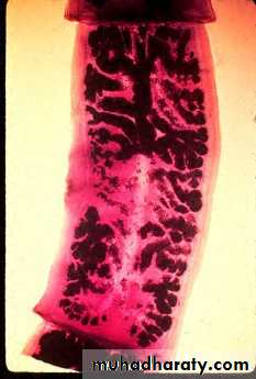 Cestodes وورد