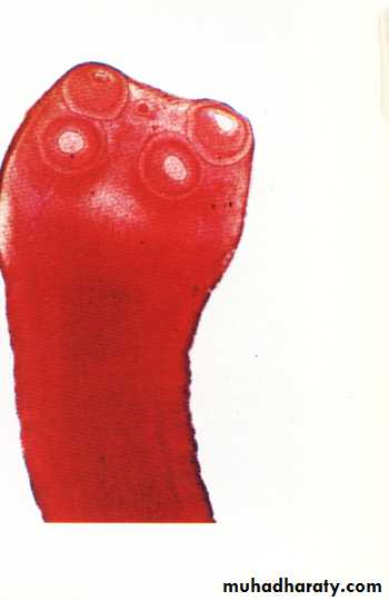 Cestodes وورد