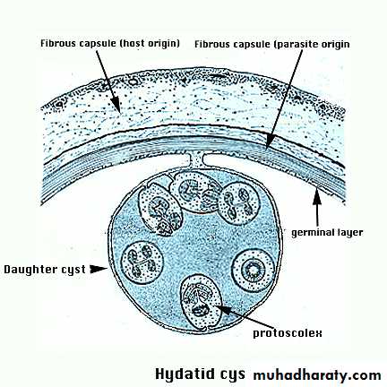 Cestodes وورد