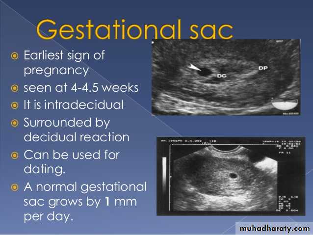 Ultrasound in Obestatric