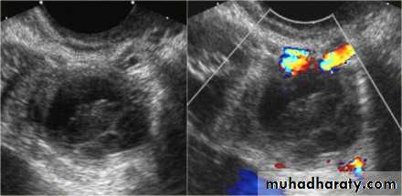 Ultrasound in Obestatric