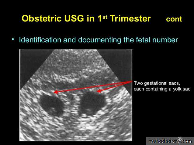 Ultrasound in Obestatric