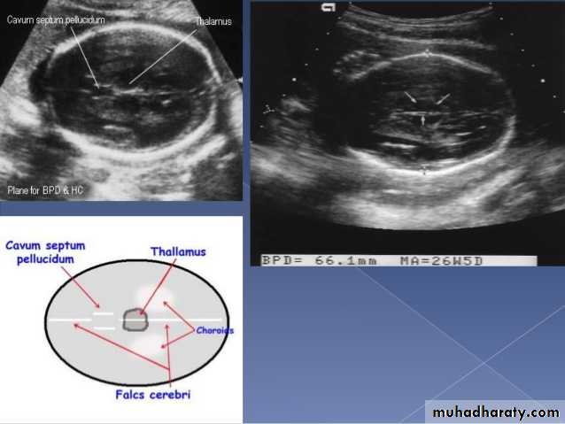 Ultrasound in Obestatric