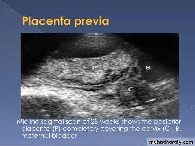 Ultrasound in Obestatric