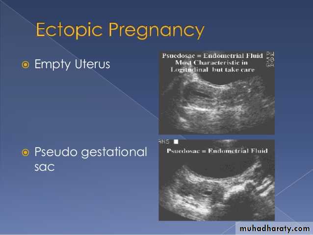 Ultrasound in Obestatric