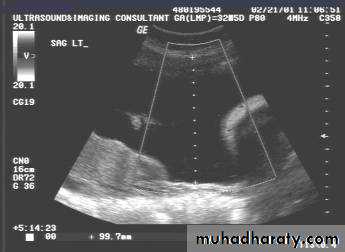 Ultrasound in Obestatric