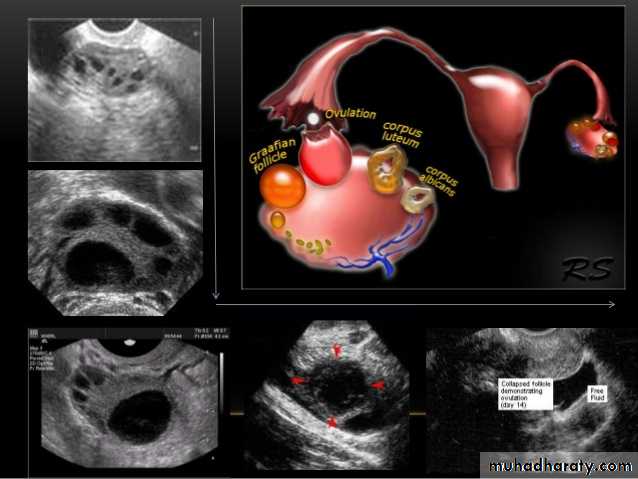 Ultrasound in Obestatric