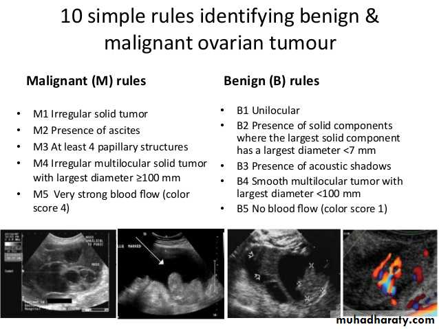 Ultrasound in Obestatric