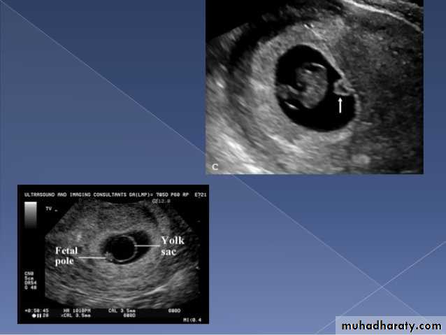 Ultrasound in Obestatric