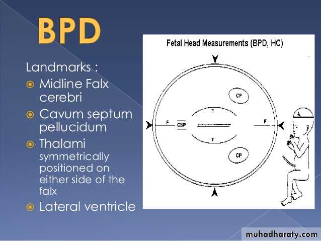 Ultrasound in Obestatric
