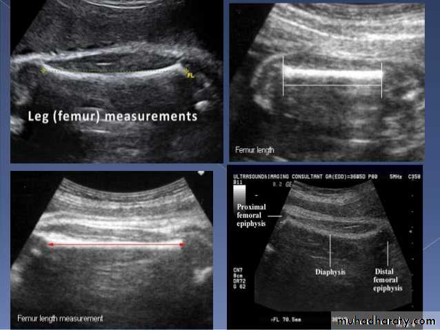 Ultrasound in Obestatric