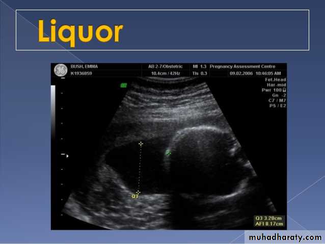 Ultrasound in Obestatric