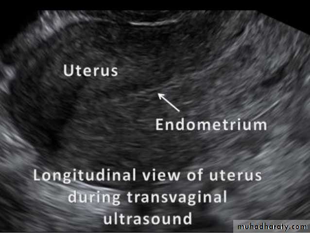 Ultrasound in Obestatric