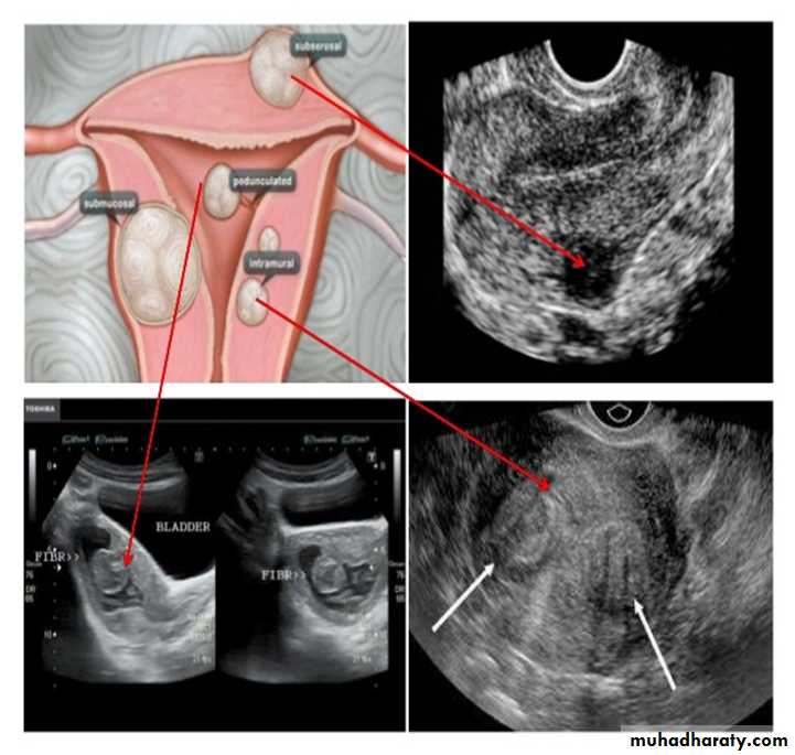 Ultrasound in Obestatric