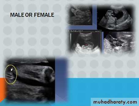 Ultrasound in Obestatric