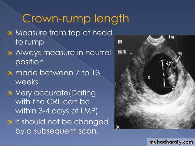 Ultrasound in Obestatric