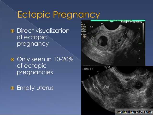 Ultrasound in Obestatric