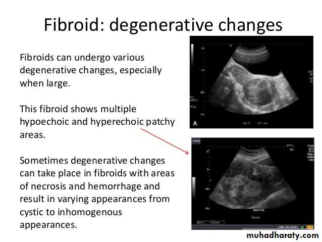 Ultrasound in Obestatric