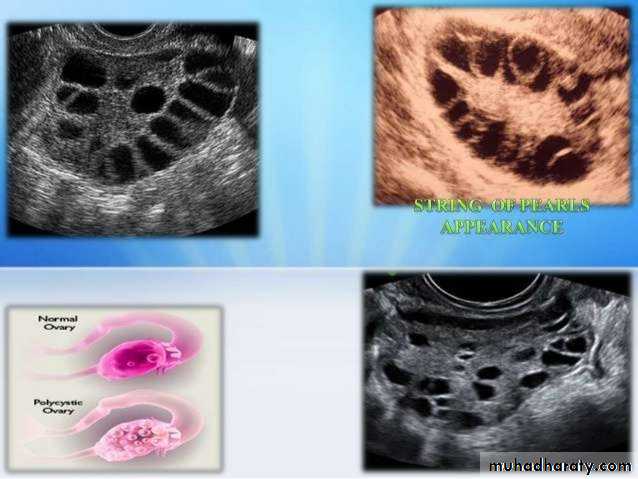 Ultrasound in Obestatric