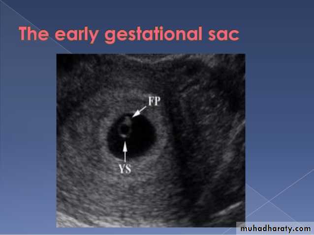 Ultrasound in Obestatric