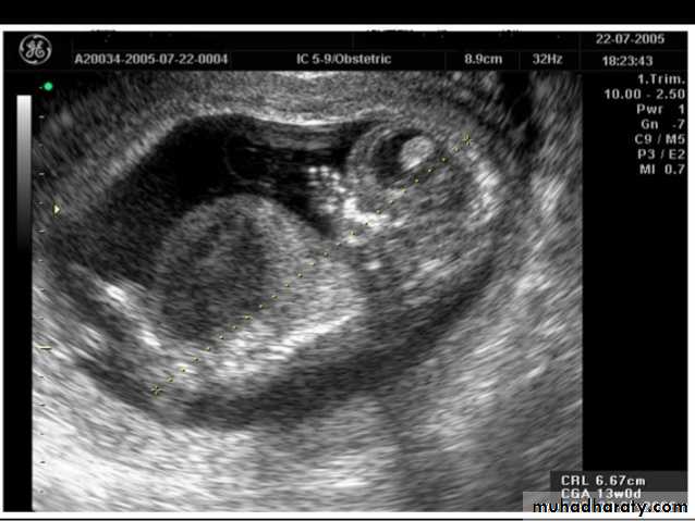 Ultrasound in Obestatric