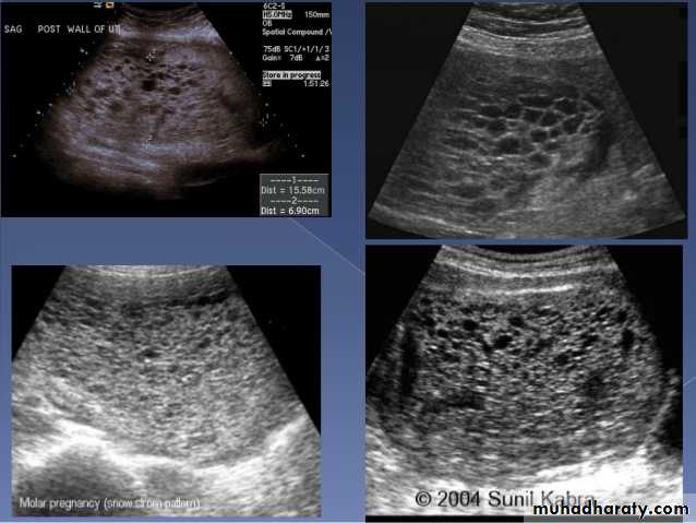 Ultrasound in Obestatric