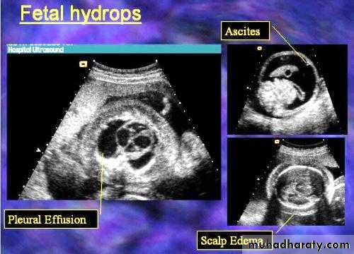 Ultrasound in Obestatric
