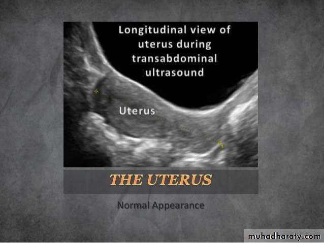 Ultrasound in Obestatric