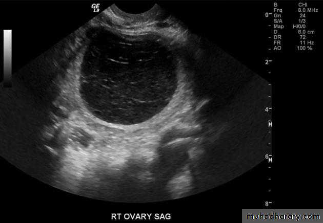 Ultrasound in Obestatric