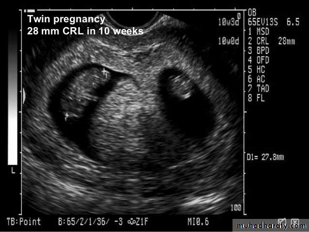 Ultrasound in Obestatric