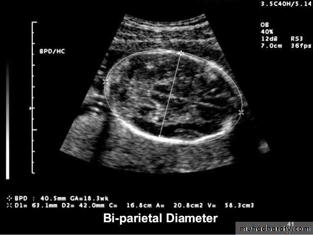 Ultrasound in Obestatric